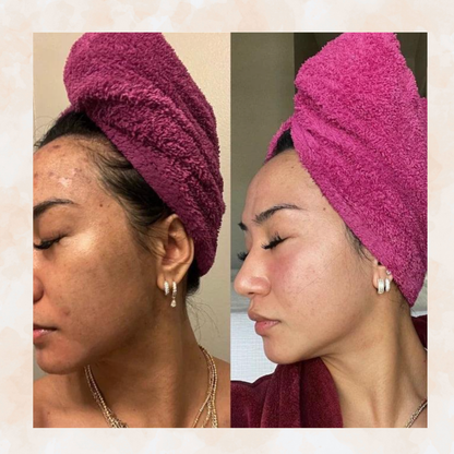 Sofele™ – Savon Éclat au Curcuma & Kojic.