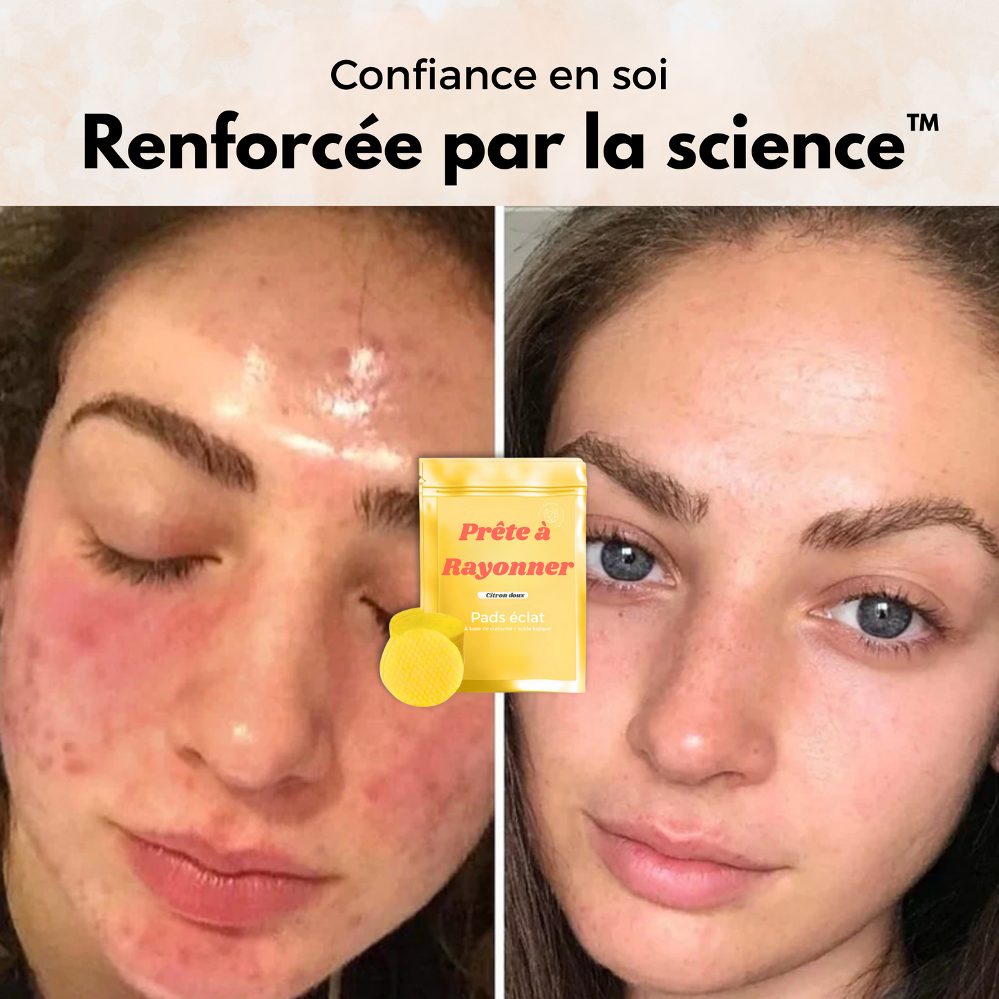 Pads Nettoyants Éclat - Sofele™