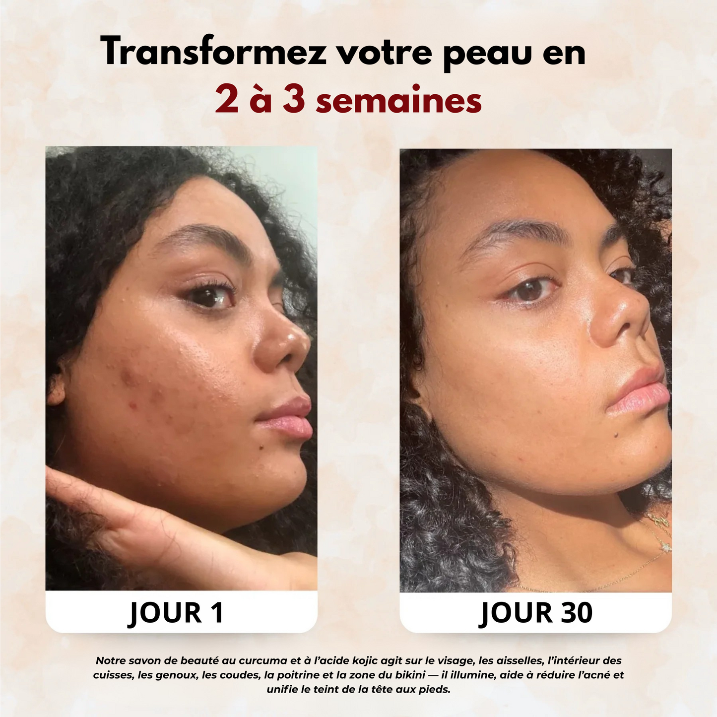 Sofele™ – Savon Éclat au Curcuma & Kojic.