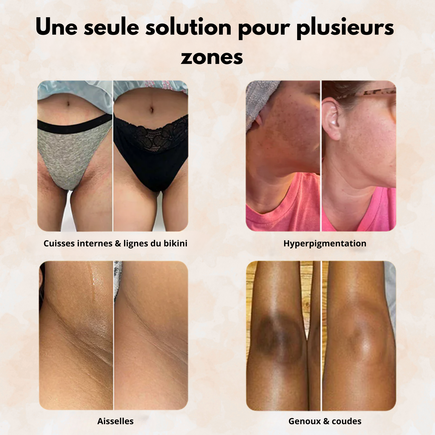 Sofele™ – Savon Éclat au Curcuma & Kojic.