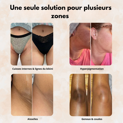 Sofele™ – Savon Éclat au Curcuma & Kojic.