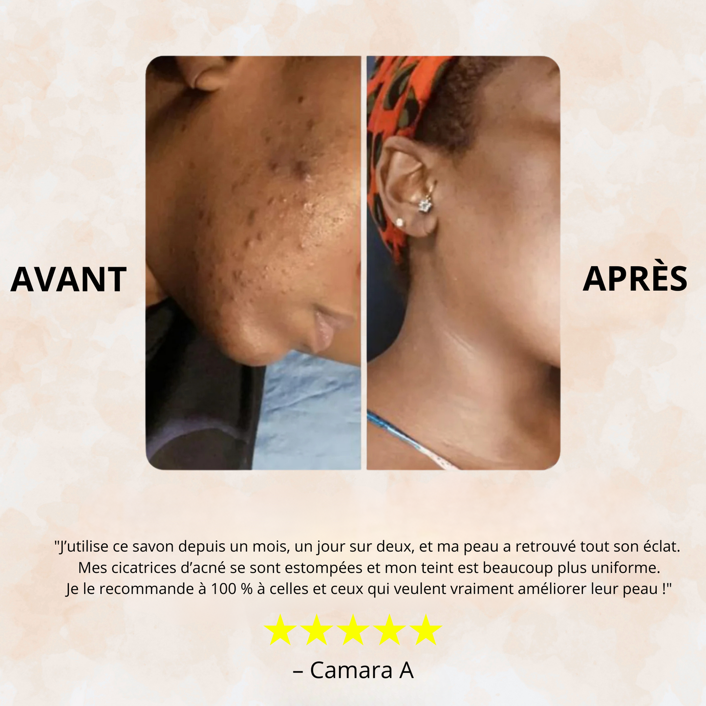 Sofele™ – Savon Éclat au Curcuma & Kojic.