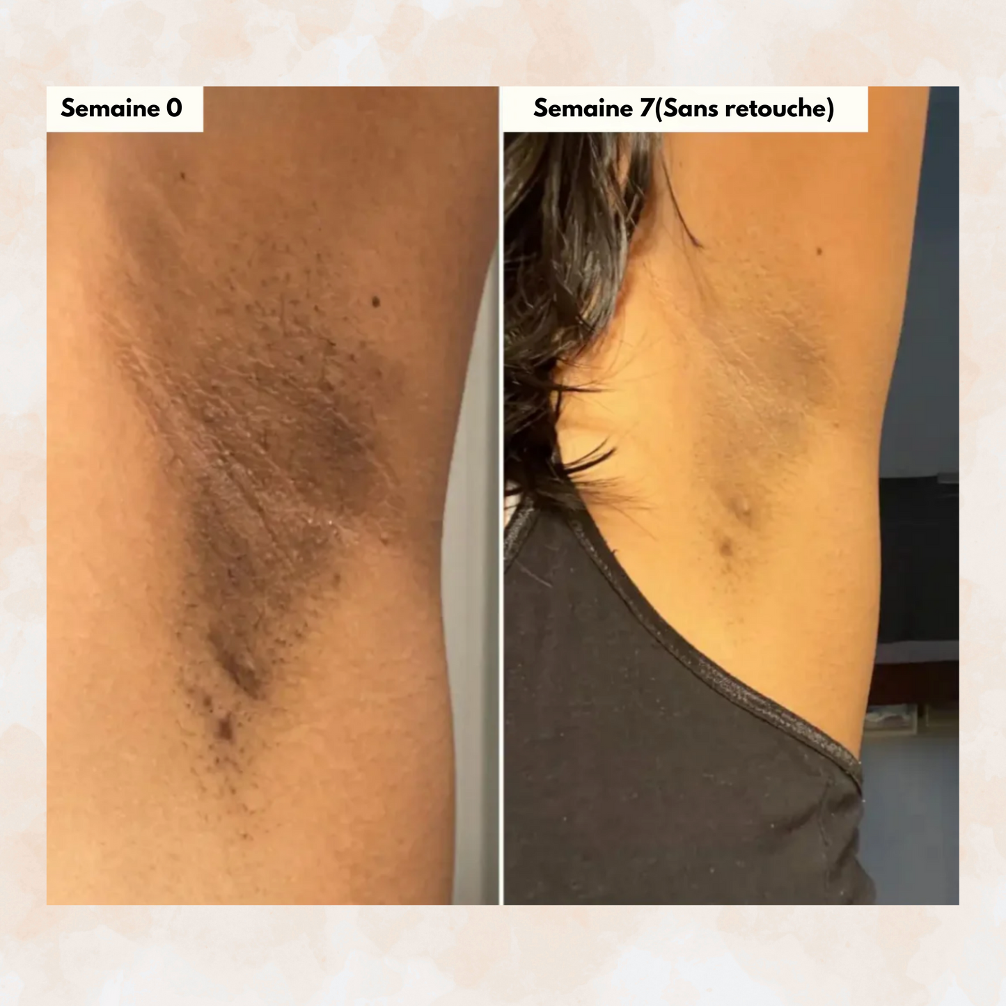 Sofele™ – Savon Éclat au Curcuma & Kojic.