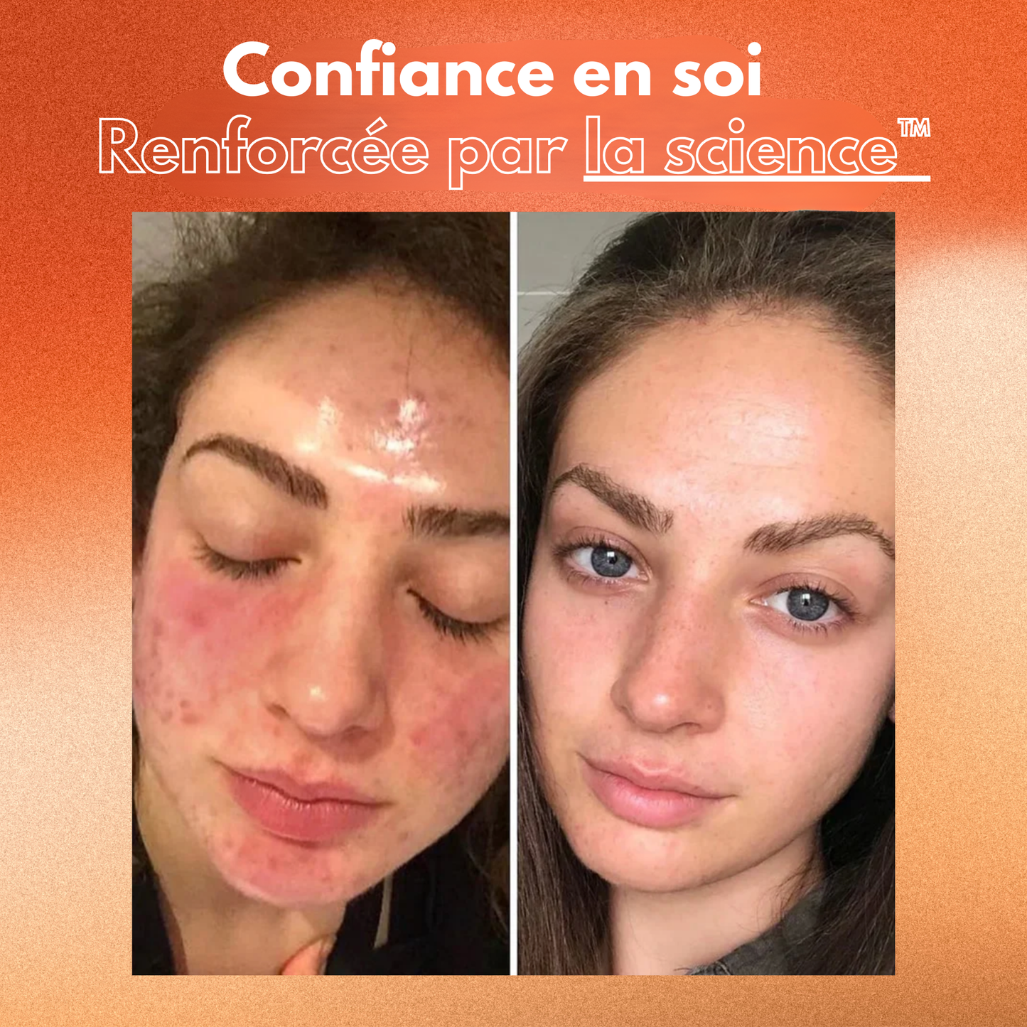 Mousse Nettoyante Éclat Sofele™
