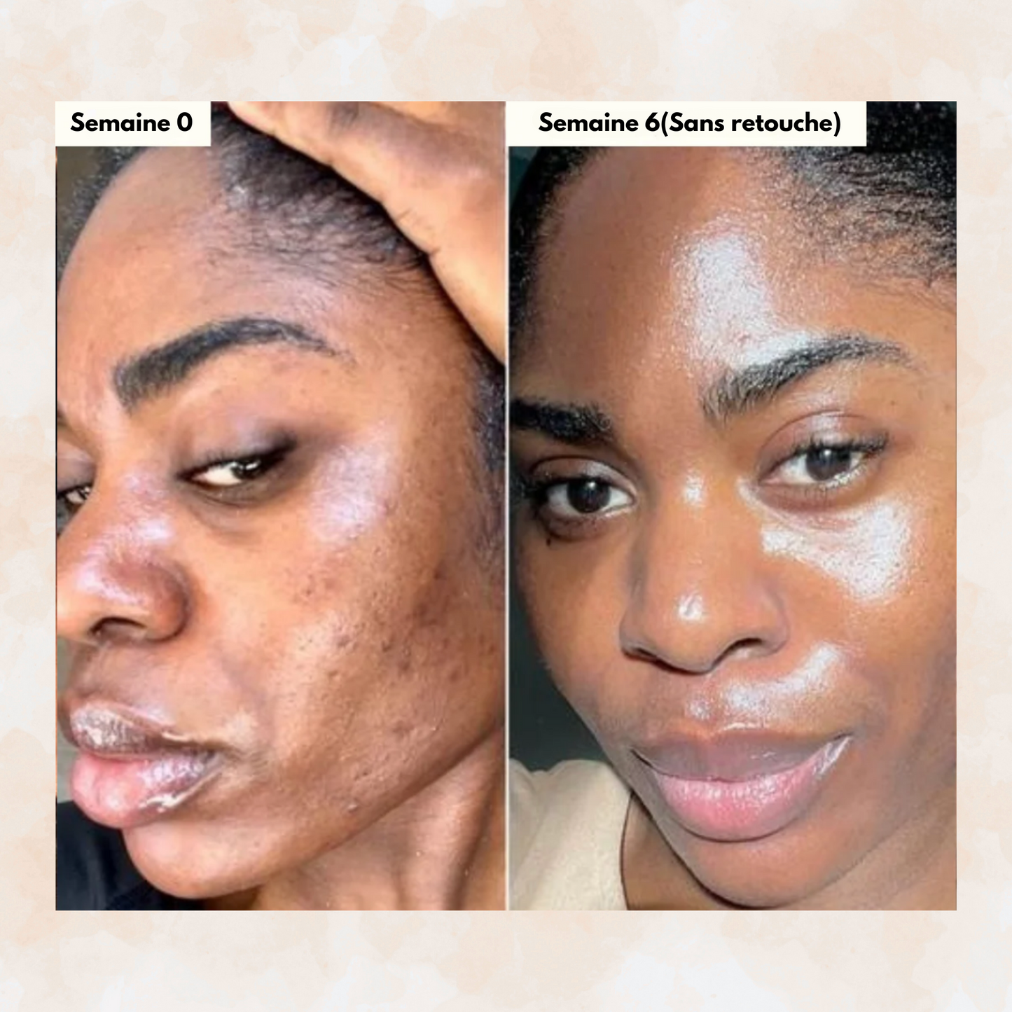 Sofele™ – Savon Éclat au Curcuma & Kojic.